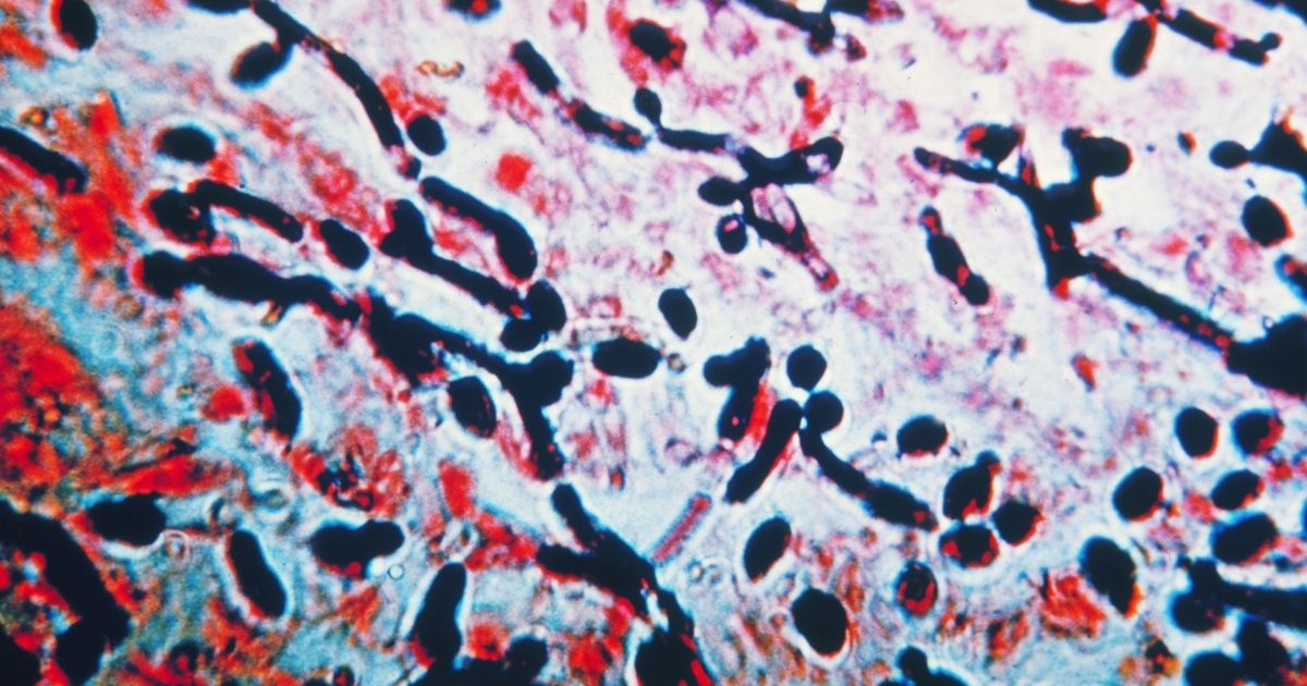 candida albicans
